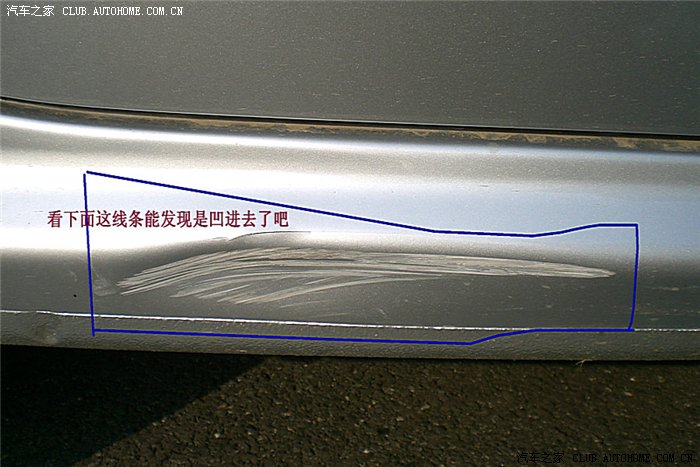 【图】这个月,有没有比我更惨更衰的狼友?上伤