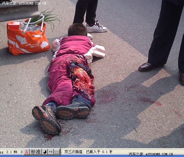 宁波联丰菜场门口斑马线货车不减速把小学生一