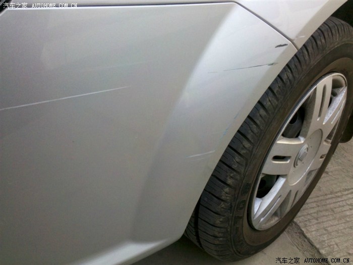 【图】今早擦破皮了,怎么处理呢?_凯越论坛_汽