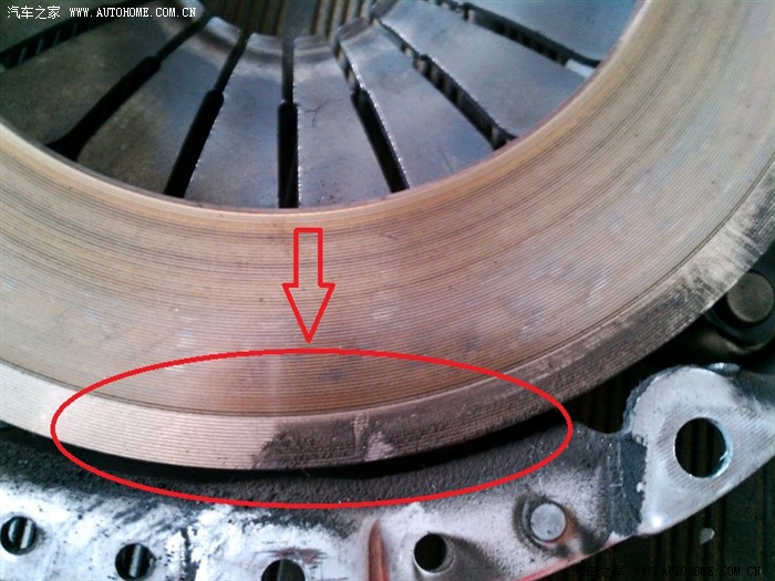 经历5个小时的大手术--爽了