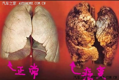 肺结核,肺癌啦说不定就是这么得的! 回复 2012-04