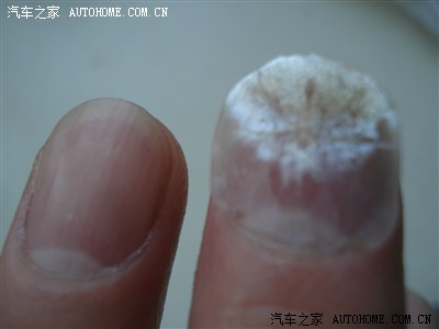 鱼鳞比手指甲还大