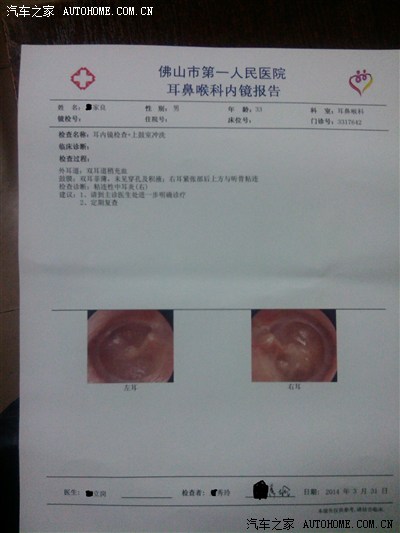 开锋驭车不到2个月。耳朵痛。检查报告大家看