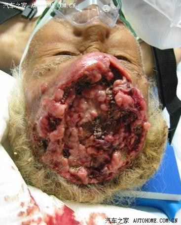 听说风云2的安全带有设计缺陷?