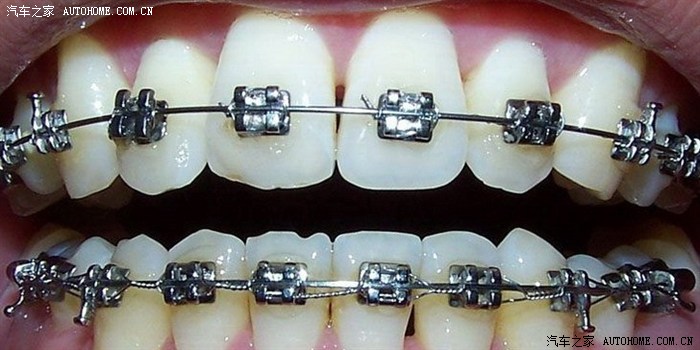 长城h6改装路虎运动版中网10几万的车改装效果